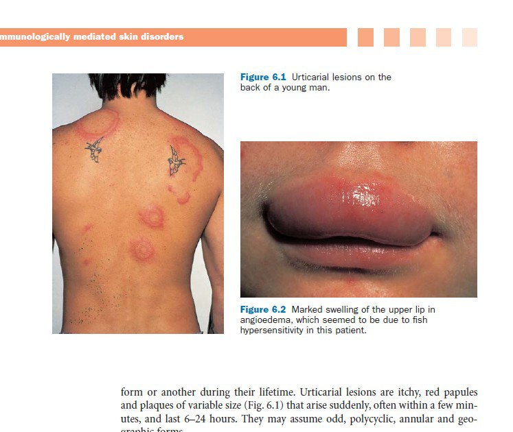 📥 Roxburgh's Common Skin Diseases, 17Ed تحميل كتاب