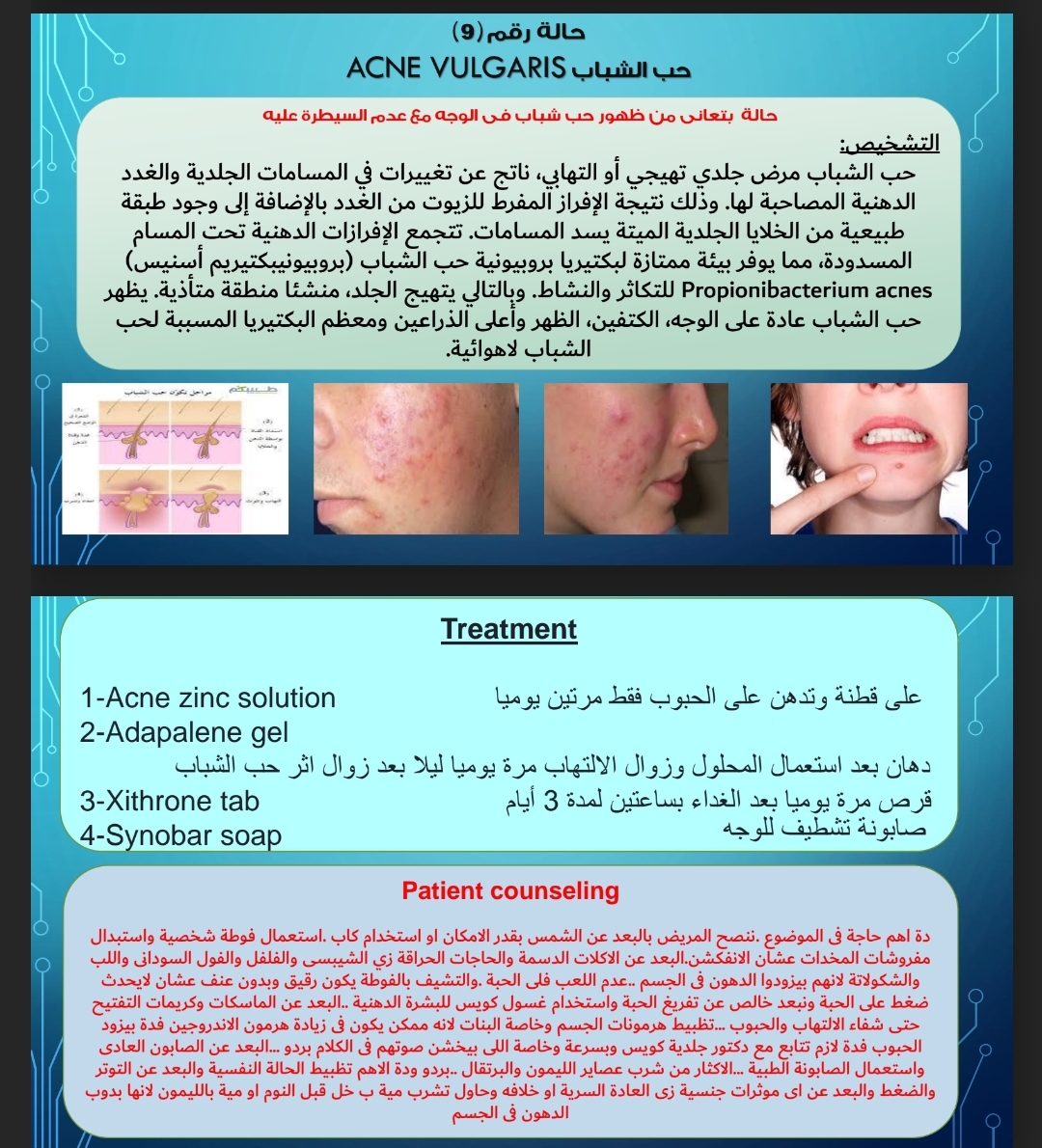 حالات otc و علاجها